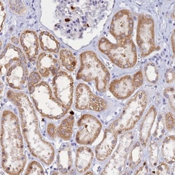 SLC26A1 Antibody, Novus Biologicals:Antibodies:Primary Antibodies